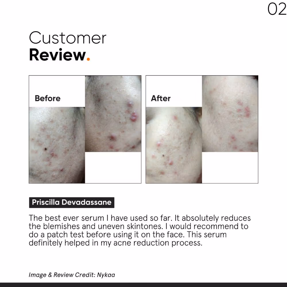 Minimalist - 10% Niacinamide - Face Serum - Matmarine + Zinc
