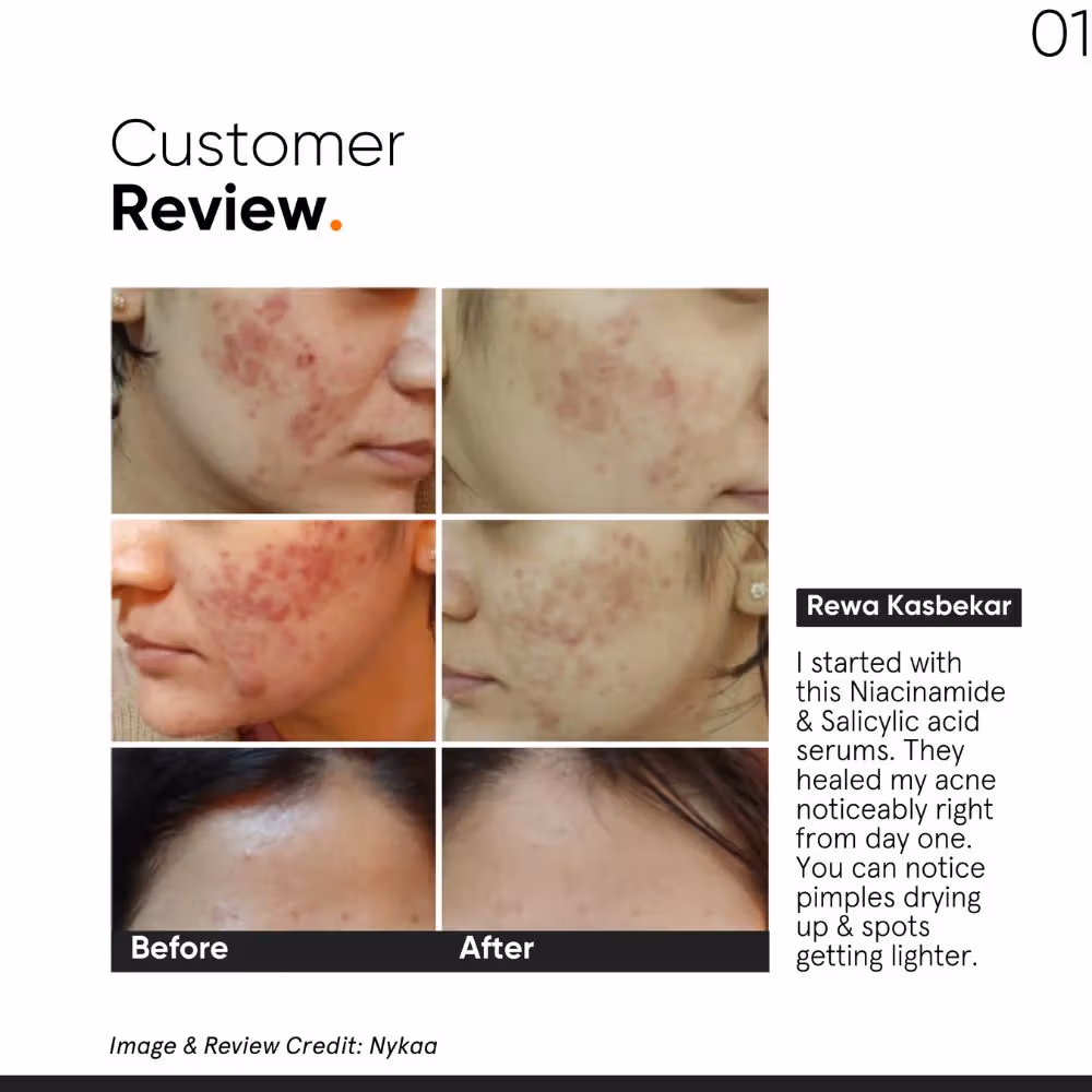 Minimalist - 2% Salicylic Acid - Face Serum - Blackheads & Whiteheads