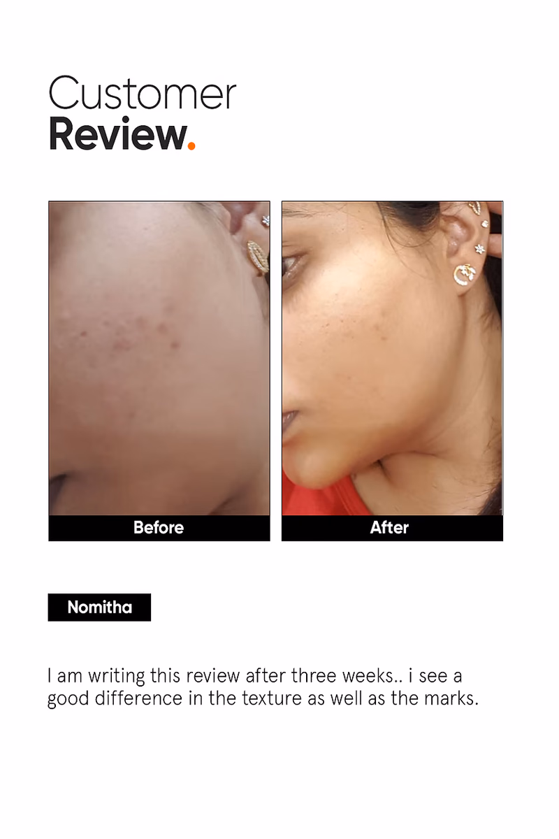 MINIMALIST - AHA PHA BHA  32 % - FACE PEEL