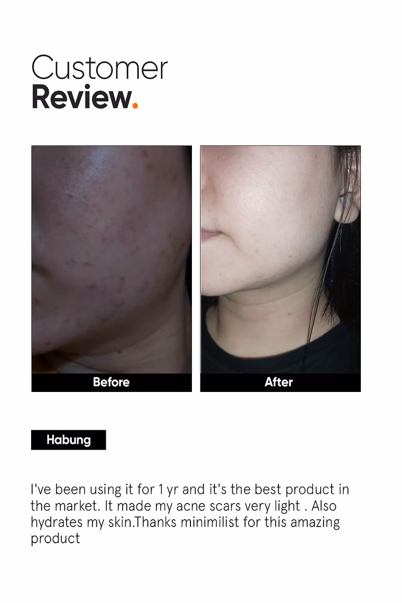 Minimalist - 2% Alpha Arbutin - Face Serum - With Butylresorcinol & Ferulic Acid