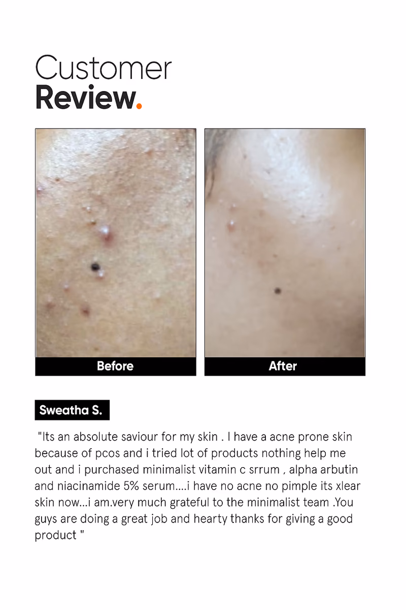 Minimalist - Vitamin C 10% - Face Serum