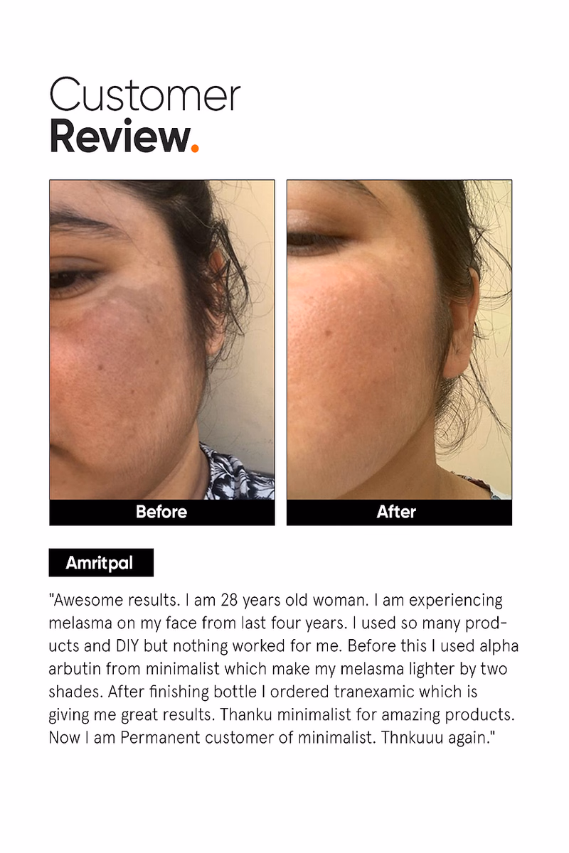 Minimalist - 3% Tranexamic Acid - Face Serum