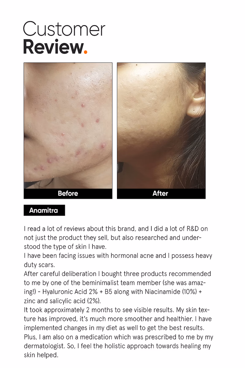 Minimalist - Hyaluronic + PGA 02% - Face Serum
