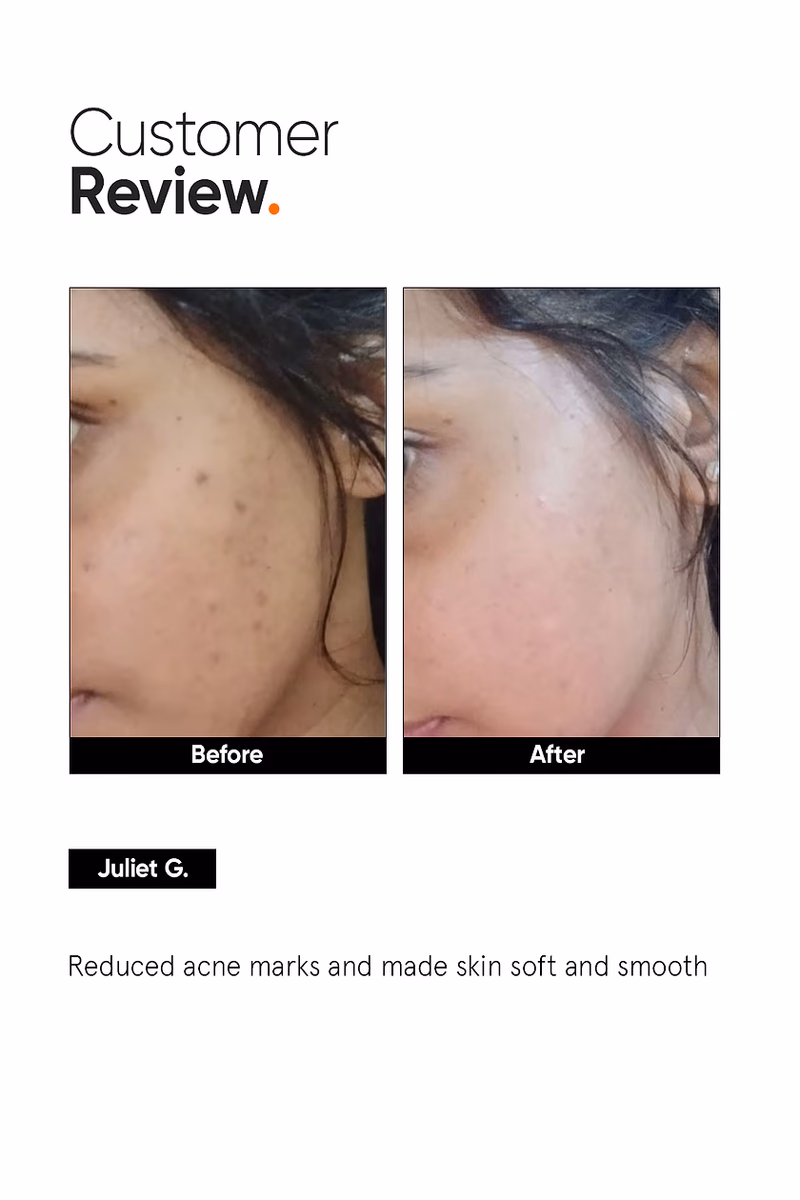Minimalist - Niacinamide 05% - Face Serum
