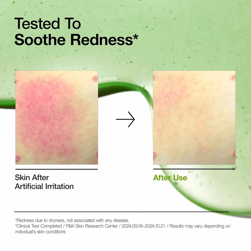Anua - Azelaic Acid 10 Hyaluron - Redness Soothing Serum - with Cica Soothes & Calms Acne-Prone Skin