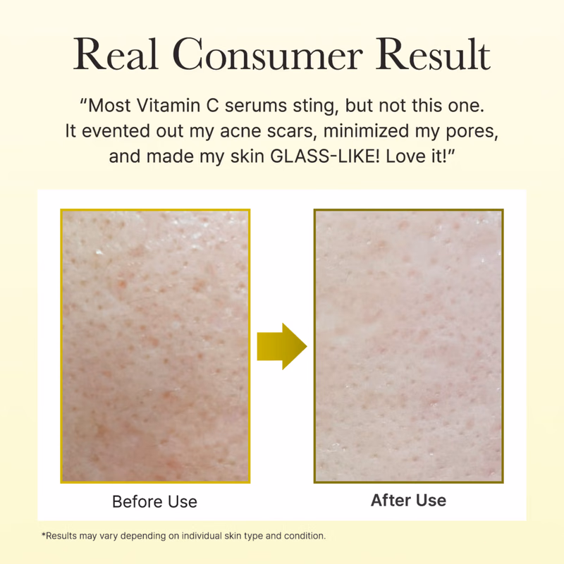 Arencia - Vitamin C Booster - Shot Serum with 5% Dual Vitamin C + Glutathione For Dark Spot Care