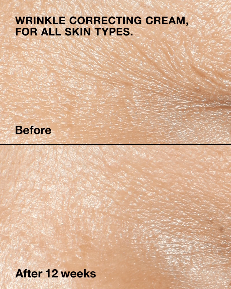 Clinique - Smart Clinical RepairΓäó Wrinkle Correcting Cream