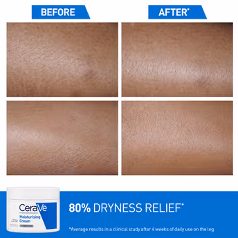 CERAVE - MOISTURIZING CREAM  -  BAUME HYDRATANT
