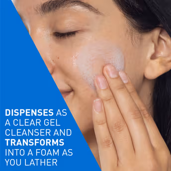CeraVe - Blemish Control Cleanser - with 2% Salicylic Acid & Niacinamide for Acne-prone skin