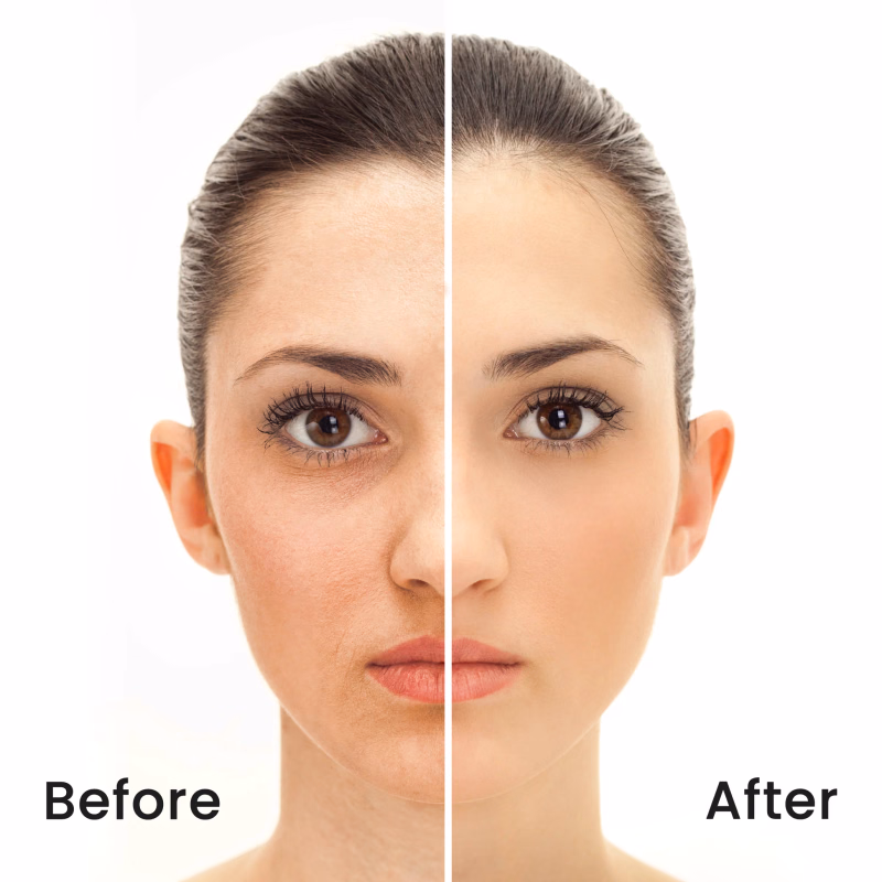 Recode - Translucent Powder - Ace Of Base - Set & Forget Fine Matte Setting