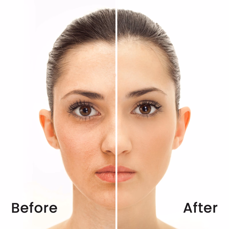 Recode - Translucent Powder - Ace Of Base - Set & Forget Fine Matte Setting