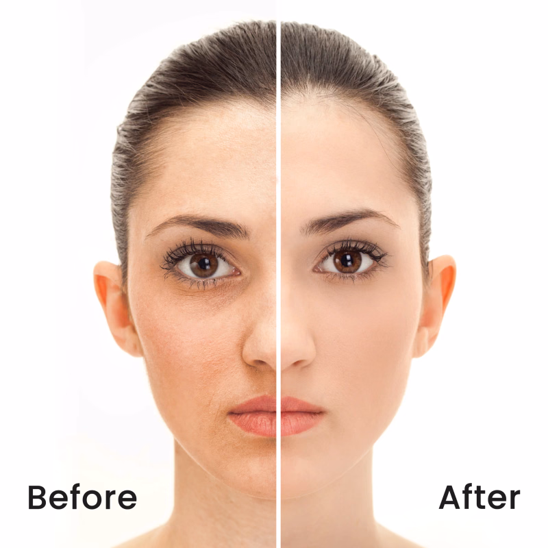 Recode - No-Hue Powder - Ace Of Base - Set & Forget Fine Matte Setting