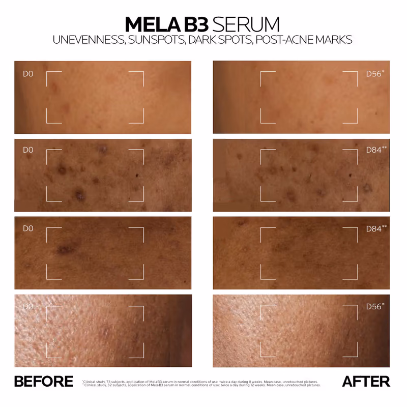 La Roche-Posay - Mela B3 Serum