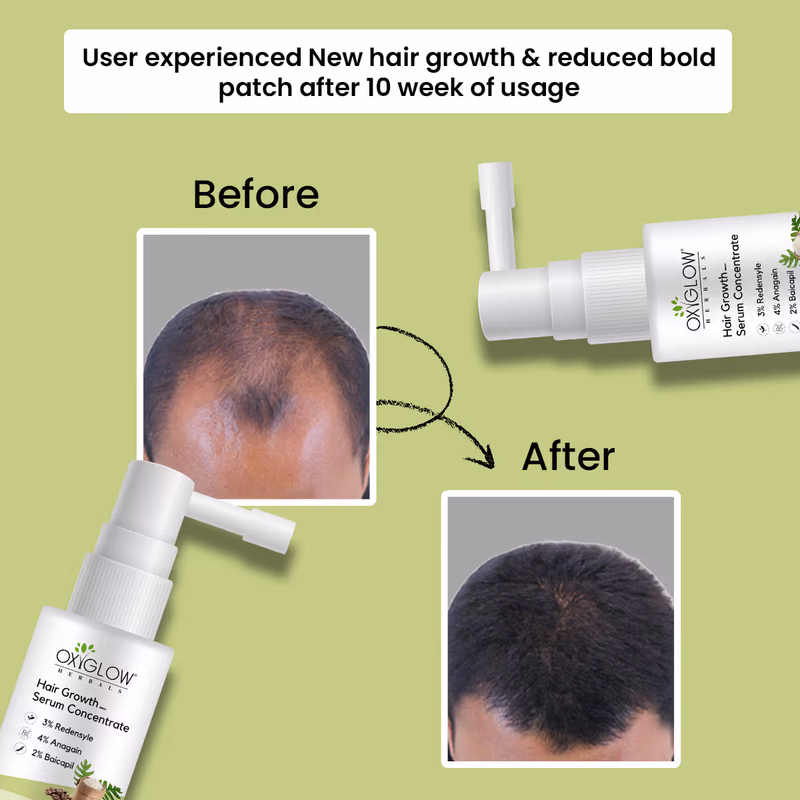 Oxyglow Herbals - Hair Growth - Serum Concentrate