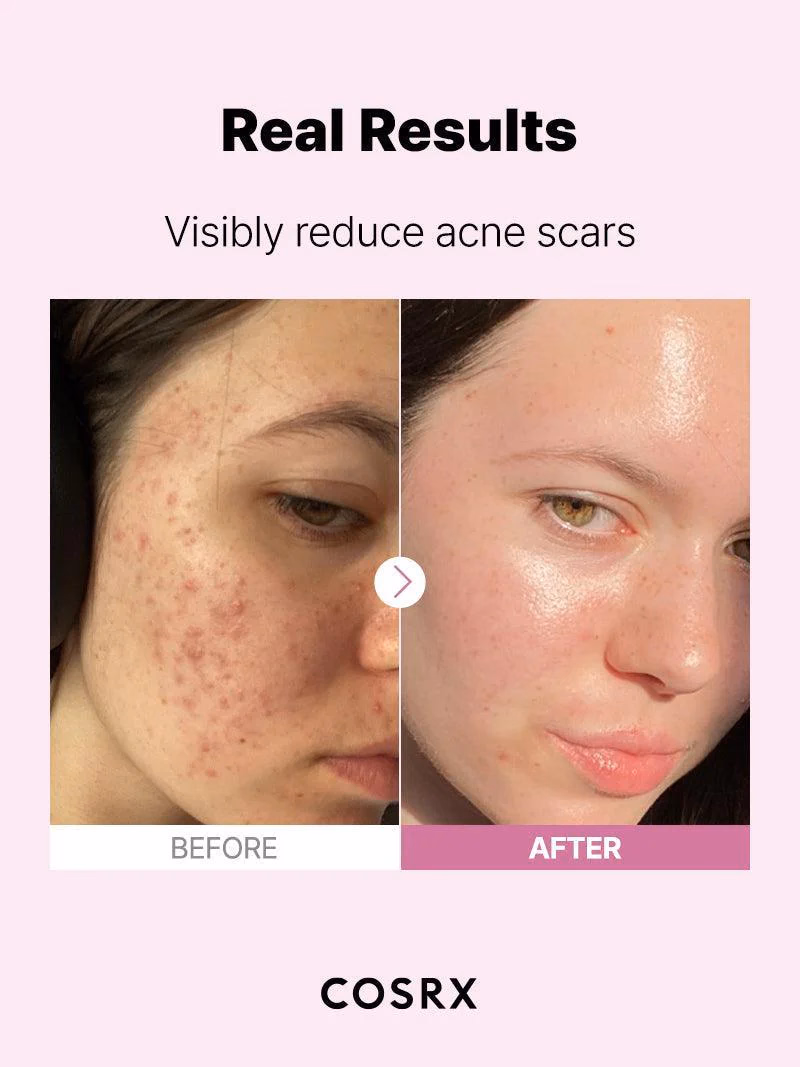 Cosrx - The Niacinamide 15 - Serum